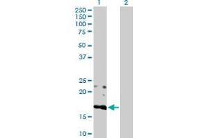 Western Blot analysis of BST2 expression in transfected 293T cell line by BST2 MaxPab polyclonal antibody. (BST2 Antikörper  (AA 1-180))