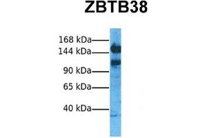 Host:  Rabbit  Target Name:  ZBTB38  Sample Tissue:  Human Hela  Antibody Dilution:  1. (ZBTB38 Antikörper  (N-Term))