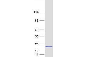Western Blotting (WB) image for Regenerating Islet-Derived 1 beta (REG1B) protein (Myc-DYKDDDDK Tag) (ABIN2730685)