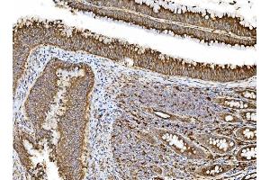 IHC analysis of PDIA5 using anti-PDIA5 antibody (ABIN7601801). (PDIA5 Antikörper  (AA 46-481))