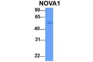 Host:  Rabbit  Target Name:  NOVA1  Sample Type:  Human Adult Placenta  Antibody Dilution:  1.