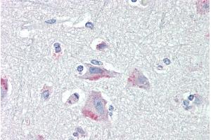ABIN190893 (5µg/ml) staining of paraffin embedded Human Cortex. (CRHR1 Antikörper  (AA 250-263))