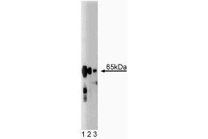 Western blot analysis of Synaptotagmin on rat brain lysate. (Synaptotagmin Antikörper  (AA 72-223))
