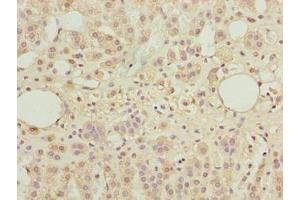 Immunohistochemistry of paraffin-embedded human adrenal gland tissue using ABIN7171598 at dilution of 1:100 (TBC1D14 Antikörper  (AA 136-435))