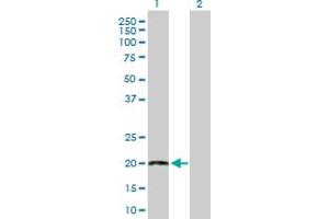 Western Blot analysis of TWIST2 expression in transfected 293T cell line by TWIST2 MaxPab polyclonal antibody.