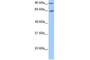 Transfected 293T; WB Suggested Anti-ZNF449 Antibody Titration: 0. (ZNF449 Antikörper  (C-Term))