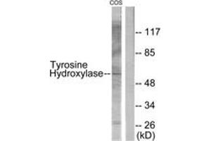 Western blot analysis of extracts from COS7, using Tyrosine Hydroxylase (Ab-31) Antibody. (Tyrosine Hydroxylase Antikörper  (AA 1-50))