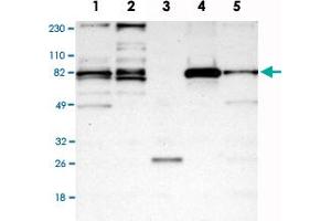 Western Blot analysis of Lane 1: RT-4, Lane 2: U-251MG sp, Lane 3: human plasma (IgG/HSA depleted), Lane 4: human liver and Lane 5: human tonsil lysates with ACSS2 polyclonal antibody . (ACSS2 Antikörper)