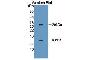 Western Blotting (WB) image for anti-NLR Family, Apoptosis Inhibitory Protein (NAIP) (AA 500-759) antibody (ABIN3206492) (NAIP Antikörper  (AA 500-759))