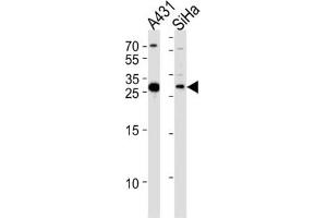 Western Blotting (WB) image for anti-Hydroxysteroid (17-Beta) Dehydrogenase 12 (HSD17B12) antibody (ABIN3004142) (HSD17B12 Antikörper)
