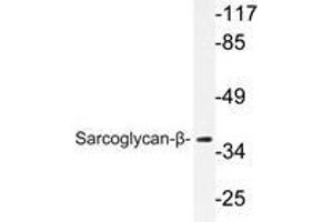 Western blot analysis of Sarcoglycan-β antibody in extracts from A549 cells. (SGCB Antikörper)