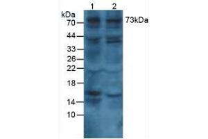 Western Blotting (WB) image for Collagen, Type VIII, alpha 1 (COL8A1) ELISA Kit (ABIN6730964)