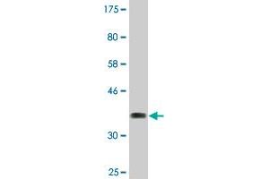Western Blot detection against Immunogen (37. (TRIM16 Antikörper  (AA 165-273))