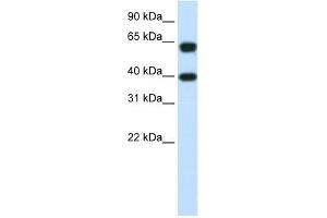 WB Suggested Anti-NXF3 Antibody Titration:  1. (NXF3 Antikörper  (C-Term))