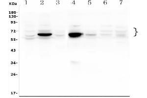 Western blot analysis of GLB1 using anti-GLB1 antibody (ABIN7599649).