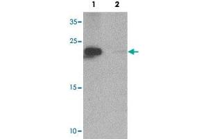 Western blot analysis of NIH/3T3 cell tissue lysate with ZFYVE21 polyclonal antibody  at 1 ug/mL in (1) the absence and (2) the presence of blocking peptide.