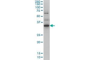 ZIC4 Antikörper  (AA 249-319)