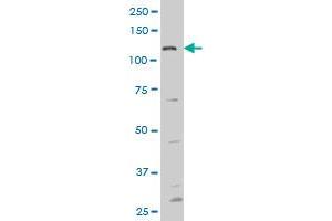 FGFR1 monoclonal antibody (M13), clone 3B2 Western Blot analysis of FGFR1 expression in COLO 320 HSR . (FGFR1 Antikörper  (AA 303-408))