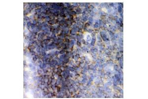 IHC analysis of Lck using anti-Lck antibody (ABIN3043870). (LCK Antikörper  (C-Term))