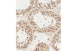 (ABIN1538275 and ABIN2849896) staining ALKBH5 in human testis tissue sections by Immunohistochemistry (IHC-P - paraformaldehyde-fixed, paraffin-embedded sections). (ALKBH5 Antikörper  (AA 302-330))
