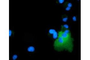 Image no. 3 for anti-rho GTPase Activating Protein 25 (ARHGAP25) antibody (ABIN1496703) (ARHGAP25 Antikörper)