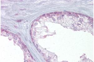 Immunohistochemical staining (Formalin-fixed paraffin-embedded sections) of human prostate with EDF1 polyclonal antibody . (EDF1 Antikörper  (AA 99-148))