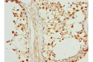 Immunohistochemistry of paraffin-embedded human testis tissue using ABIN7169217 at dilution of 1:100 (VRK1 Antikörper  (AA 257-396))