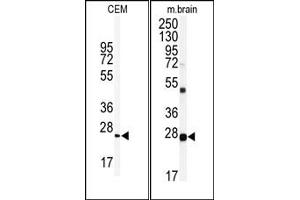 Image no. 2 for anti-Ubiquitin Carboxyl-terminal Esterase L1 (Ubiquitin Thiolesterase) (UCHL1) (N-Term) antibody (ABIN357509) (UCHL1 Antikörper  (N-Term))