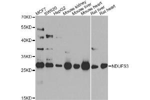 Western blot analysis of extracts of various cell lines, using NDUFS3 antibody.