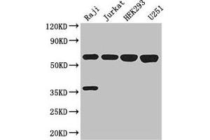 Western Blot Positive WB detected in: Raji whole cell lysate, Jurkat whole cell lysate, HEK293 whole cell lysate, U251 whole cell lysate All lanes: KPNA2 antibody at 3 μg/mL Secondary Goat polyclonal to rabbit IgG at 1/50000 dilution Predicted band size: 58 kDa Observed band size: 58 kDa