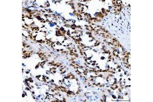IHC analysis of SP1 using anti-SP1 antibody (ABIN7601559). (SP1 Antikörper  (AA 384-603))