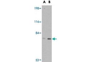 Western blot analysis of LRFN5 in EL4 cell lysate with LRFN5 polyclonal antibody  at (A) 0.