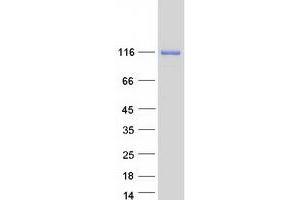 CAND2 Protein (Transcript Variant 1) (Myc-DYKDDDDK Tag)