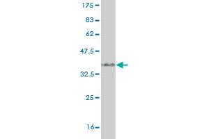 Western Blot detection against Immunogen (35. (SYN1 Antikörper  (AA 362-450))