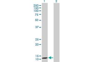 Western Blot analysis of CCNB3 expression in transfected 293T cell line by CCNB3 MaxPab polyclonal antibody. (Cyclin B3 Antikörper  (AA 1-111))