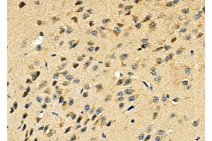ABIN6264833 and ABIN6279044 at 1/100 staining Mouse brain tissue by IHC-P. (RPL29 Antikörper  (Internal Region))