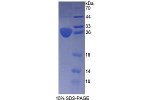 SDS-PAGE analysis of Human ARNT2 Protein. (ARNT2 Protein)