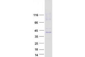 Validation with Western Blot (SLC29A1 Protein (Transcript Variant 1) (Myc-DYKDDDDK Tag))