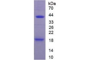 SDS-PAGE analysis of Mouse IL1R1 Protein. (IL1R1 Protein)