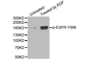 Western Blotting (WB) image for anti-Epidermal Growth Factor Receptor (EGFR) (pTyr1016) antibody (ABIN1870114) (EGFR Antikörper  (pTyr1016))