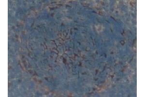 Immunohistochemistry (IHC) image for anti-TNF Receptor Superfamily, Member 6 (FAS) (AA 21-170) antibody (ABIN7438937)