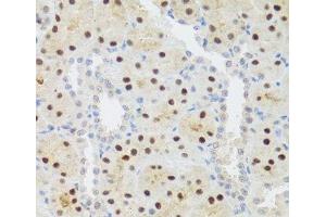 Immunohistochemistry of paraffin-embedded Rat kidney using STAT4 Polyclonal Antibody at dilution of 1:100 (40x lens). (STAT4 Antikörper)