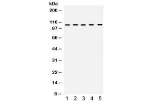 Western blot testing of 1) rat testis, 2) rat ovary, 3) human SKOV, 4) COLO320 and 5) human HeLa lysate with TRIM28 antibody. (KAP1 Antikörper  (AA 699-835))