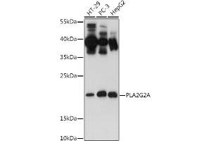 Western blot analysis of extracts of various cell lines, using PLG2A antibody (ABIN3021801, ABIN3021802, ABIN3021803 and ABIN6215942) at 1:500 dilution. (PLA2G2A Antikörper  (AA 21-144))