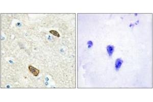 Immunohistochemistry analysis of paraffin-embedded human brain, using PLXDC1 Antibody. (PLXDC1 Antikörper  (AA 71-120))