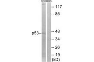Western blot analysis of extracts from COS7 cells, treated with UV, using p53 (Ab-9) Antibody. (p53 Antikörper  (AA 8-57))