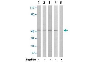 Western blot analysis of extracts from COLO cells (Lane 1 and 5), HT-29 cells (Lane 2), A-549 cells (Lane 3) and 293 cells (Lane 4), using IL13RA1 polyclonal antibody . (IL13 Receptor alpha 1 Antikörper)