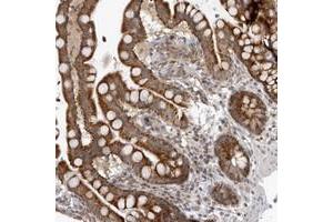 Immunohistochemical staining of human colon with MRPS15 polyclonal antibody  strong cytoplasmic positivity in glandular cells. (MRPS15 Antikörper)