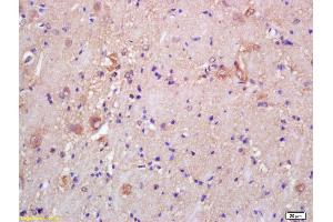 Formalin-fixed and paraffin embedded rat brain labeled with Rabbit Anti CKMT/Creatine kinase MT Polyclonal Antibody, Unconjugated (ABIN717536) at 1:200 followed by conjugation to the secondary antibody and DAB staining (CKMT1B Antikörper  (AA 115-220))