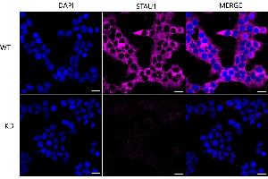 Immunocytochemical staining of Hela cells using STAU1 antibody (ABIN7800434), 1:1,000), Top panel: wild-type (WT), Bottom panal: STAU1 shRNA knockdown (KD). (Rekombinanter STAU1/Staufen Antikörper)